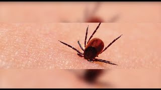 Lyme Disease Test Melbourne Florida