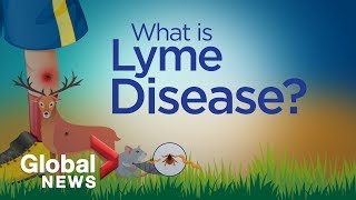 Lyme Disease Physician Eugene Oregon