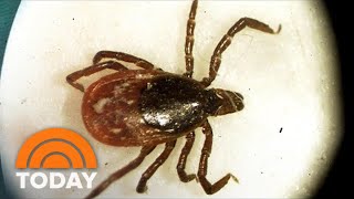 Lyme Disease Cure Georgia